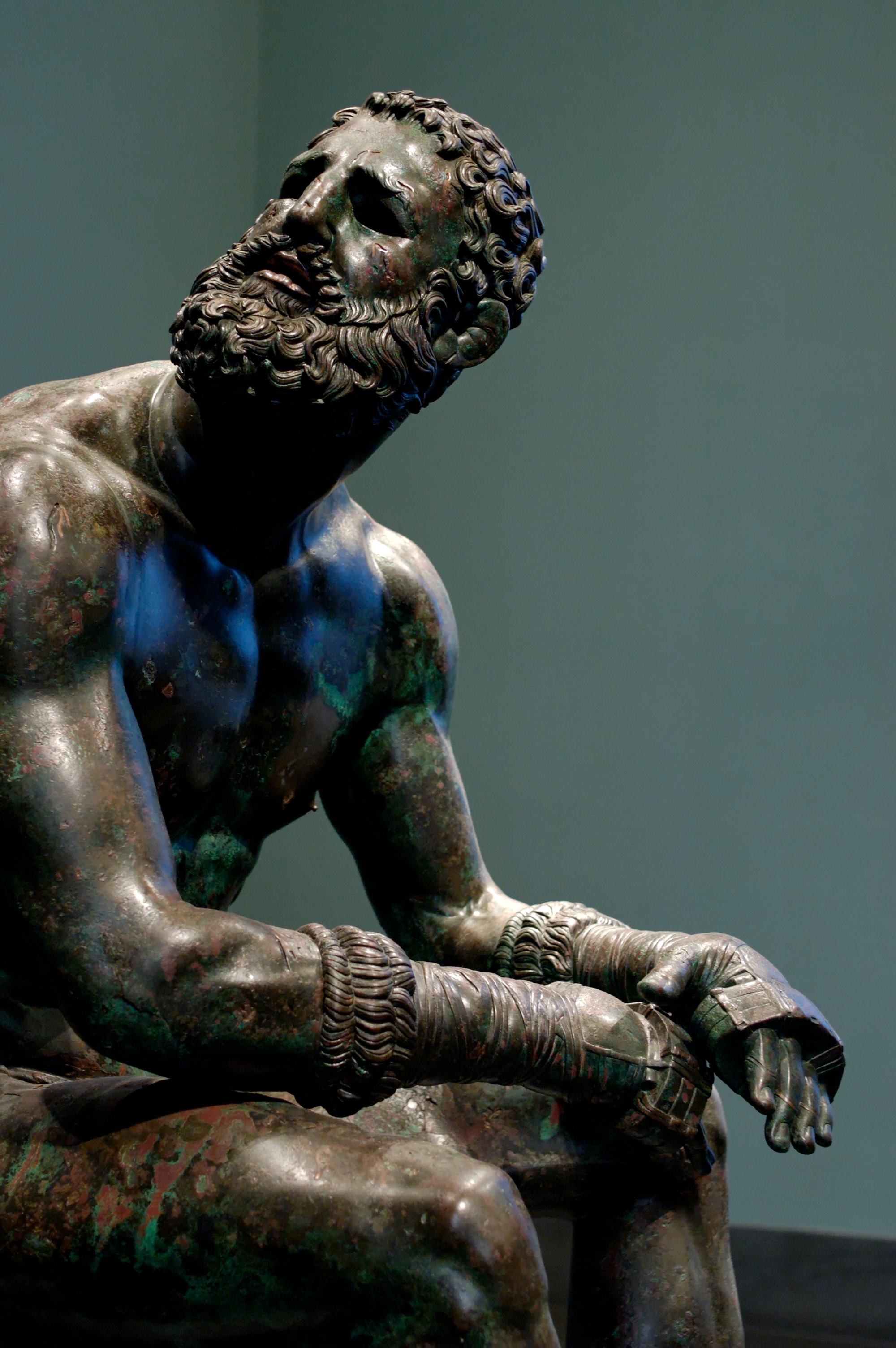 Farnese_boxer_Massimo_Inv1055_n2